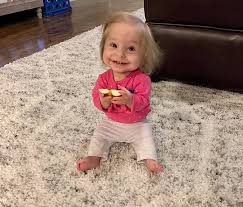 Image result for Nanismo Primordial