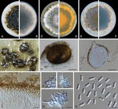 Attēlu rezultāti vaicājumam “Didymium spongiosum var. dictyospora”