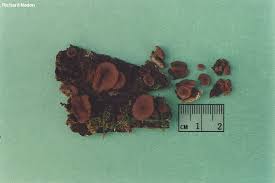 Attēlu rezultāti vaicājumam “Ascocoryne cylichnium”