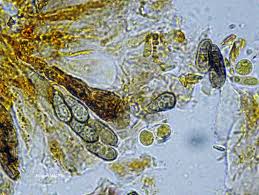 Attēlu rezultāti vaicājumam “Arthonia vinosa”