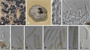 Attēlu rezultāti vaicājumam “Licea minima spores”