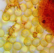 Attēlu rezultāti vaicājumam “Gulielmina vermicularis spores”