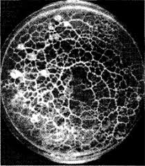 Attēlu rezultāti vaicājumam “Cribraria intricata spores”