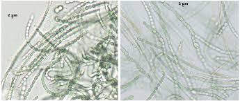 Attēlu rezultāti vaicājumam “Nostoc commune cells”