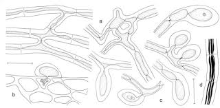 Attēlu rezultāti vaicājumam “Octosporella jungermanniarum”