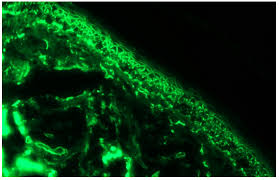 Attēlu rezultāti vaicājumam “Pemphigus borealis”