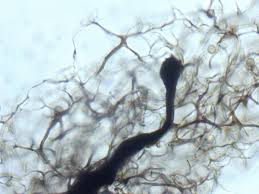 Attēlu rezultāti vaicājumam “Stemonitis lignicola spores”