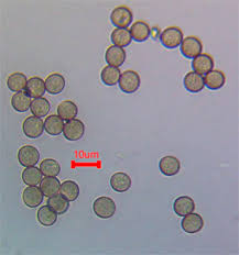 Attēlu rezultāti vaicājumam “Comatricha elegans stalked”
