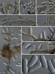 Attēlu rezultāti vaicājumam “Dianema depressum spores”