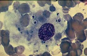 Attēlu rezultāti vaicājumam “Leiocolea rutheana cells”