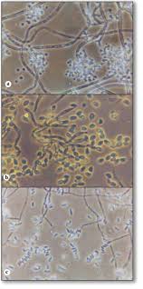Attēlu rezultāti vaicājumam “Badhamiopsis praetermissa spores”