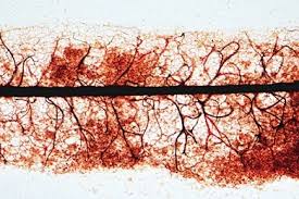 Attēlu rezultāti vaicājumam “Stemonitis foliicola spores”