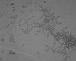 Attēlu rezultāti vaicājumam “Trichia longipalpis spores”