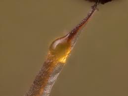 Attēlu rezultāti vaicājumam “Clastoderma debaryanum spores”