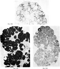 Image result for Leucoraja erinaceus