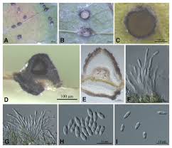 Attēlu rezultāti vaicājumam “Diachea dictyospora (syn. Craterium dictyosporum) spores”