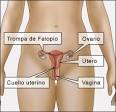 Clamidia - <b>Enfermedades</b> de Transmisión Sexual