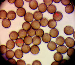 Attēlu rezultāti vaicājumam “Colloderma sp.”
