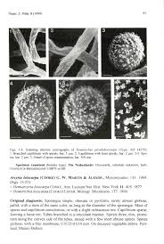Attēlu rezultāti vaicājumam “Arcyria stipata spores”