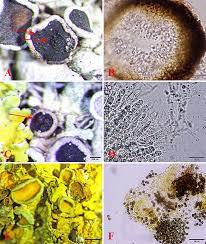 Attēlu rezultāti vaicājumam “Lichenoconium xanthoriae”