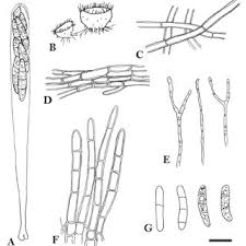 Attēlu rezultāti vaicājumam “Diderma deplanatum spores”