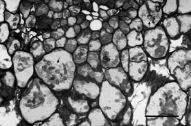 Attēlu rezultāti vaicājumam “Uromyces dactylidis”