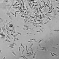 Attēlu rezultāti vaicājumam “Hymenoscyphus fructigenus”