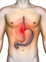 Home Remedies for Acidity and Gas Problems | MinMit