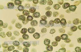 Attēlu rezultāti vaicājumam “Mnium hornum sporophyte”