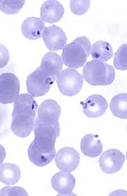 Attēlu rezultāti vaicājumam “Cribraria purpurea plasmodium”