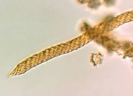 Attēlu rezultāti vaicājumam “Oligonema affine spores”