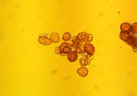 Attēlu rezultāti vaicājumam “Urocystis anemones”