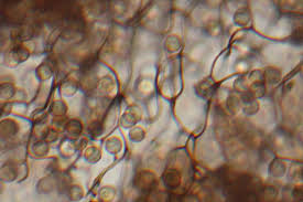 Attēlu rezultāti vaicājumam “Cribraria argillacea macro”