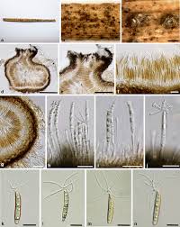 Attēlu rezultāti vaicājumam “Rosellinia desmazieri spores”