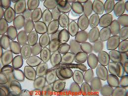 Attēlu rezultāti vaicājumam “Diderma globosum spores”