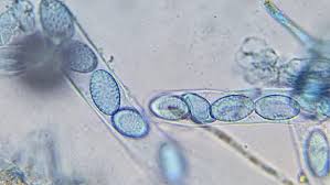 Attēlu rezultāti vaicājumam “Octospora humosa”