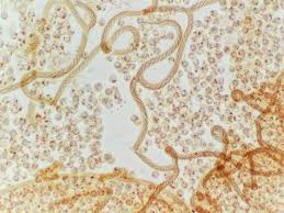 Attēlu rezultāti vaicājumam “Hemitrichia calyculata stalked”