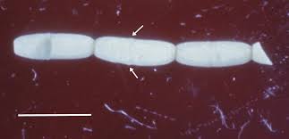 Image result for cestoda excrement dog