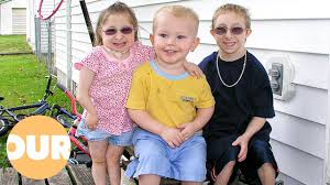 Image result for Nanismo Primordial