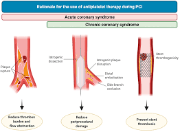 Image result for Hemonetics CCS