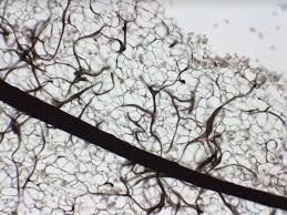 Attēlu rezultāti vaicājumam “Stemonitis axifera var. smithii”