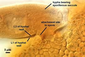 Attēlu rezultāti vaicājumam “Ombrophila violacea spores”