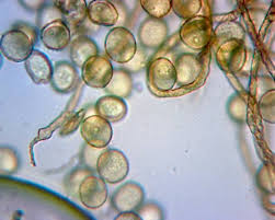 Attēlu rezultāti vaicājumam “Trichia contorta spores”