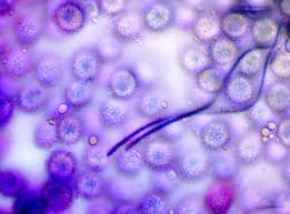 Attēlu rezultāti vaicājumam “Dianema depressum macro”