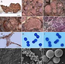 Attēlu rezultāti vaicājumam “Lycogala sp.”