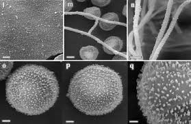 Attēlu rezultāti vaicājumam “Lignydium muscorum spores”