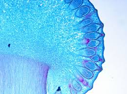 Attēlu rezultāti vaicājumam “Claviceps purpurea”