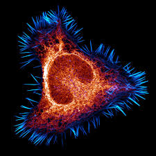 Attēlu rezultāti vaicājumam “Arcyria major macro”