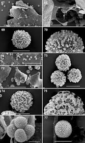 Attēlu rezultāti vaicājumam “Diderma testaceum spores”