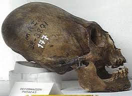 Image result for elongated skulls